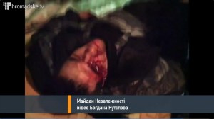 Maidan18_02_VerletzterBerkutOhneAuge2326