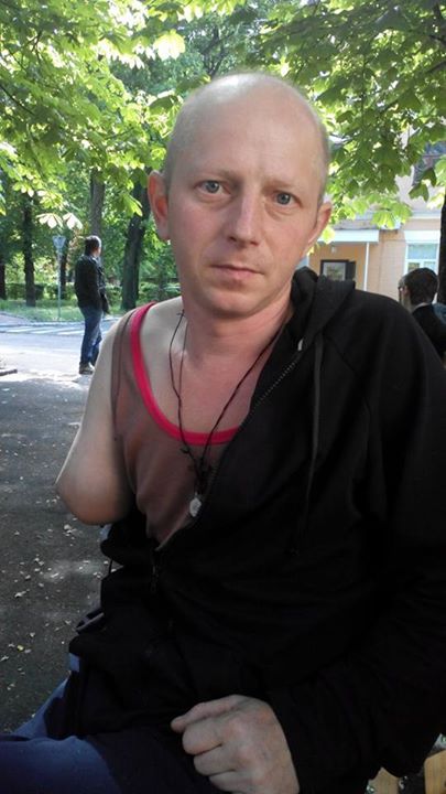 Andrew Sharayenko, 40 years old, from Bila Tserkva. Voluntarily mobilized in February of this year. He served in the 17th Territorial Defense Battalion "Kirovograd" in Horlivka. On April 17, during a battle he received a serious wound in his right hand and in Dzerzhinsk it was amputated. He was then transferred to Kharkiv and then to the Kyiv military hospital, where he is now. He still has to undergo rehabilitation and obtain expensive prosthetics. Source